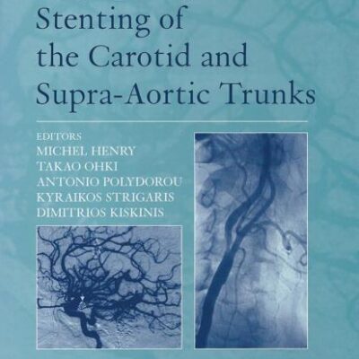 Angioplasty and Stenting of Carotid and Supra-aortic Trunks