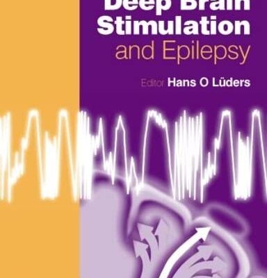 Deep Brain Stimulation and Epilepsy