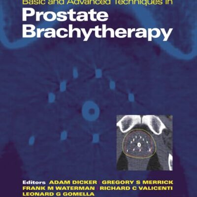 Basic and Advanced Techniques in Prostate Brachytherapy