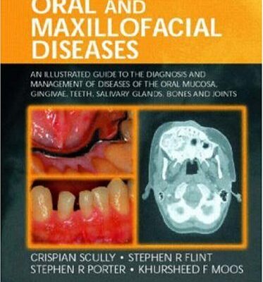 Oral And Maxillofacial Diseases: An Illustrated Guide to Diagnosis and Management of Diseases of the Oral Mucosa, Gingivae, Teeth, Salivary Glands, Bones and Joints, Third Edition