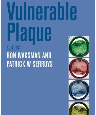 Handbook of the Vulnerable Plaque