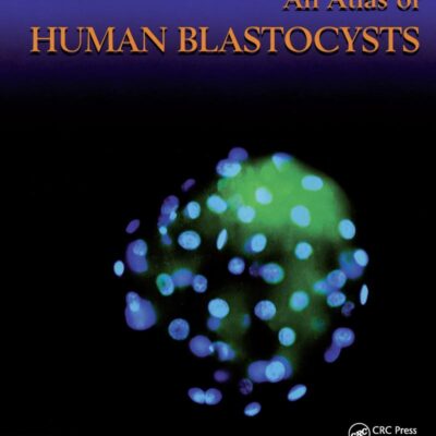An Atlas of Human Blastocysts (Encyclopedia of Visual Medicine Series)