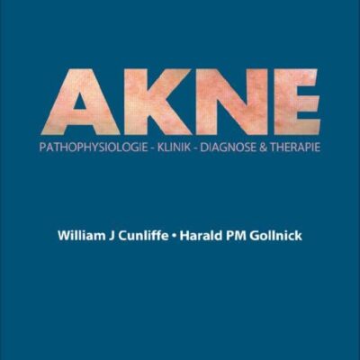 Acne: Diagnose und Therapie