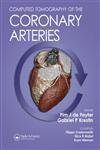 Computed Tomography of the Coronary Arteries