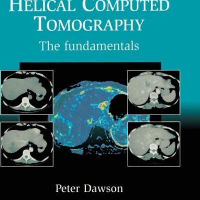 PROTOCOLS FOR MULTISLICE HELICAL COMPUTED TOMOGRAPHY: THE FUNDAMENTALS