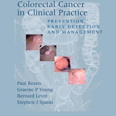 Colorectal Cancer in Clinical Practice: Prevention, Early Detection and Management, Second Edition