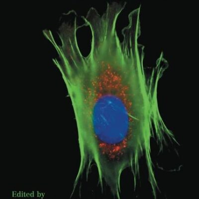 Case Studies in Lipid Management