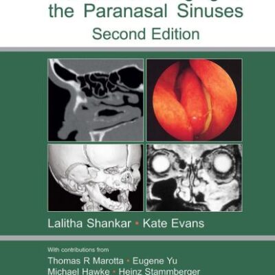 AN ATLAS OF IMAGING OF THE PARANASAL SINUSES 2/E