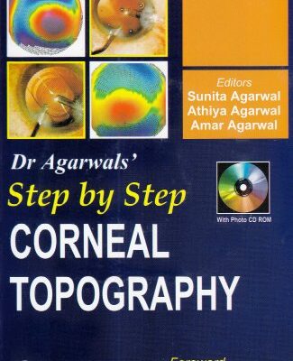 Step by Step Corneal Topography