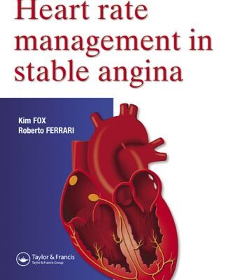 Heart Rate Management in Stable Angina