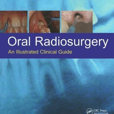 ORAL RADIOSURGERY AN ILLUSTRATED CLINICAL GUIDE
