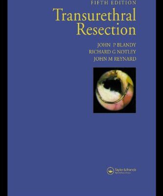 (EX)TRANSURETHRAL RESECTION