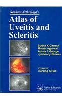 Sankara Nethralaya's Atlas of Uveitis and Scleritis