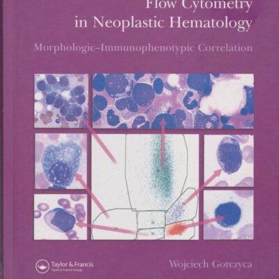 Flow Cytometry in Neoplastic Hematology: Morphologic--Immunophenotypic Correlation