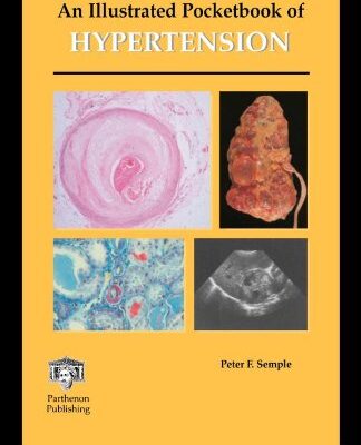An Illustrated Pocketbook of Hypertension