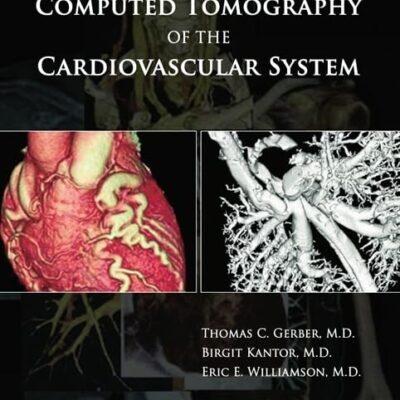 Computed Tomography of the Cardiovascular System