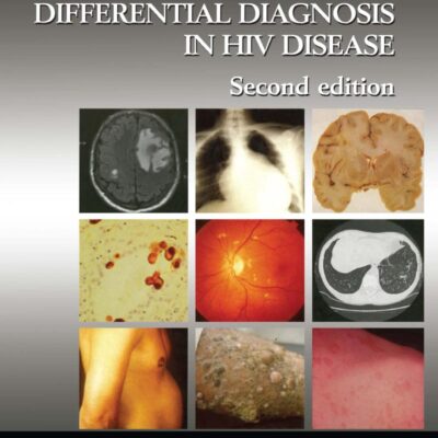 Atlas of Differential Diagnosis in HIV Disease: 72 (Encyclopedia of Visual Medicine Series)