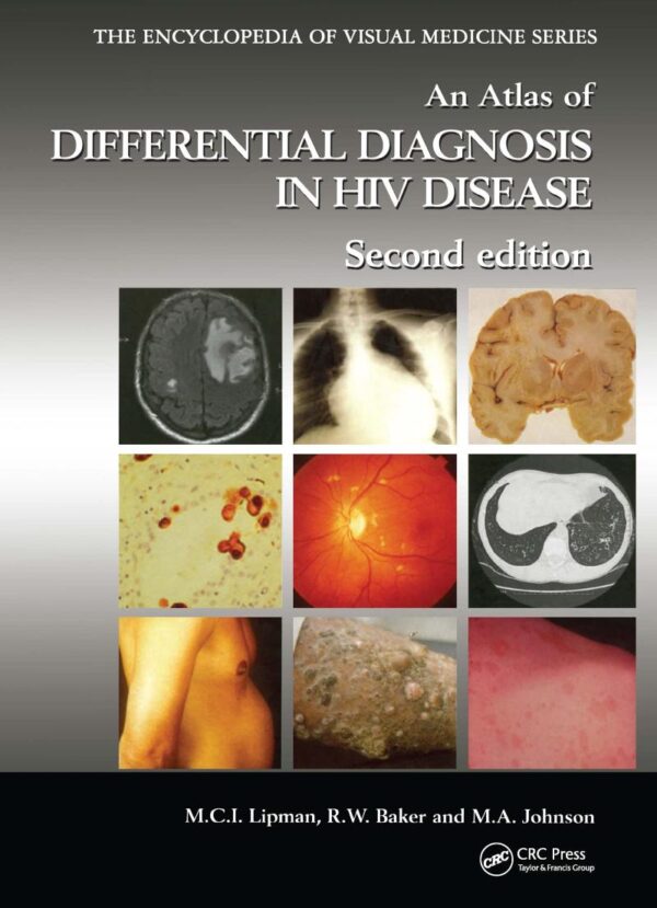 Atlas of Differential Diagnosis in HIV Disease: 72 (Encyclopedia of Visual Medicine Series)