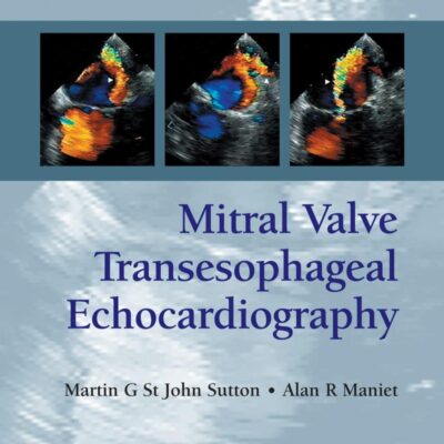 Mitral Valve Transesophageal Echocardiography