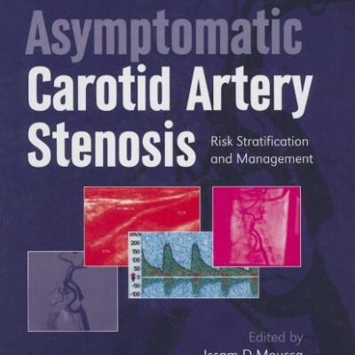 ASYMPTOMATIC CAROTID ARTERY STENOSIS RISK STRATIFICATION AND MANAGEMENT
