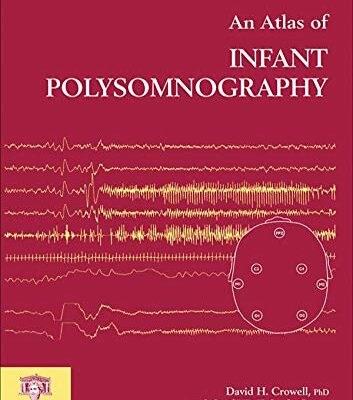 An Atlas of Infant Polysomnography (Encyclopedia of Visual Medicine Series, 60)
