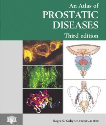 AN ATLAS OF PROSTATIC DISEASES (ENCYCLOPEDIA OF VISUAL MEDICINE SERIES)