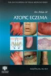 AN ATLAS OF ATOPIC ECZEMA (Encyclopedia of Visual Medicine Series)