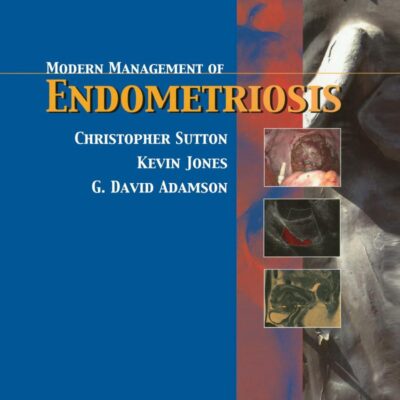 Modern Management of Endometriosis