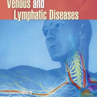 VENOUS AND LYMPHATIC DISEASES