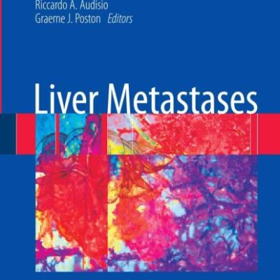 LIVER METASTASES