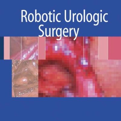 Robotic Urologic Surgery