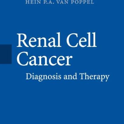 RENAL CELL CANCER: DIAGNOSIS AND THERAPY