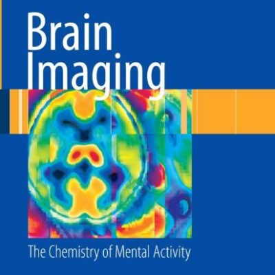 Brain Imaging (Hb): The Chemistry of Mental Activity