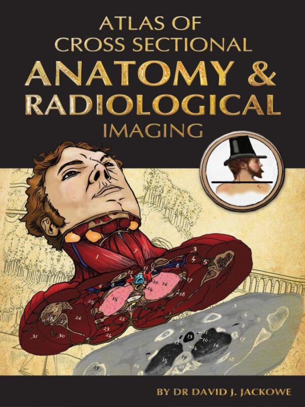 Atlas Of Cross Sectional Anatomy And Radiological Imaging (Pb 2013)