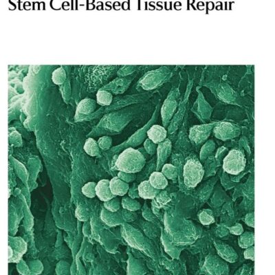 Stem Cell Based Tissue Repair (Hb 2011)