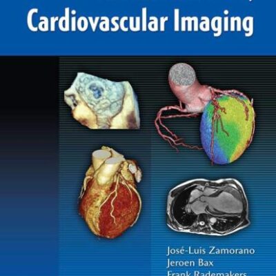 The Esc Textbook of Cardiovascular Imaging