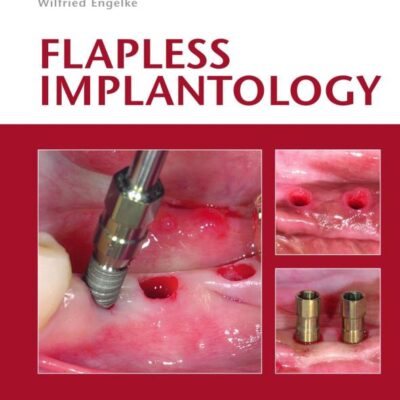 Flapless Implantology (Hb 2010)