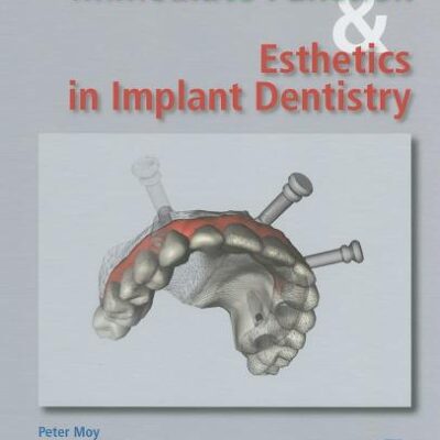 Immediate Function And Esthetics In Implant Dentistry (Hb 2008)