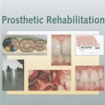 PROSTHETIC REHABILITATION (HB 2007)