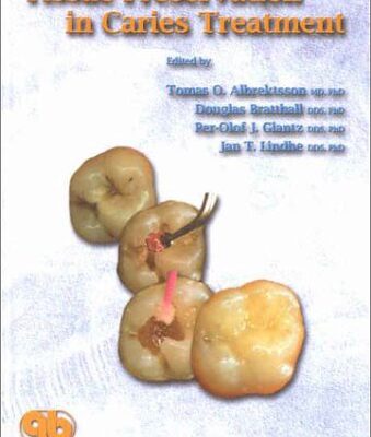 Tissue Preservation In Caries Treatment (Hb 2001)