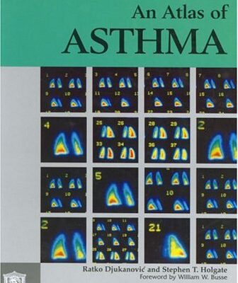 An Atlas of Asthma (Encyclopedia of Visual Medicine Series)