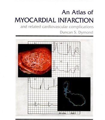 An Atlas of Myocardial Infarction and Related Cardiovascular Complications (Encyclopedia of Visual Medicine Series)