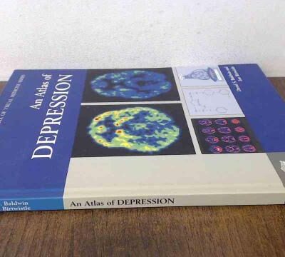 An Atlas of Depression (Encyclopedia of Visual Medicine Series)