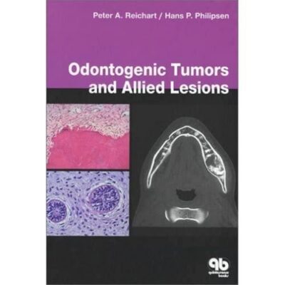 Odontogenic Tumours And Allied Lesions (Hb 2004)