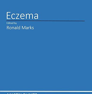 ECZEMA