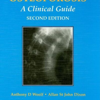 OSTEOPOROSIS: A Clinical Guide