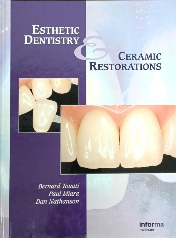 Esthetic Dentistry and Ceramic Restorations