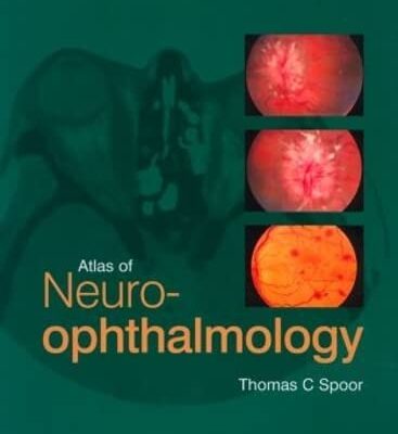 Atlas of Neuro-ophthalmology
