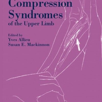 Nerve Compression Syndromes of the Upper Limb