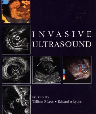 Invasive Ultrasound